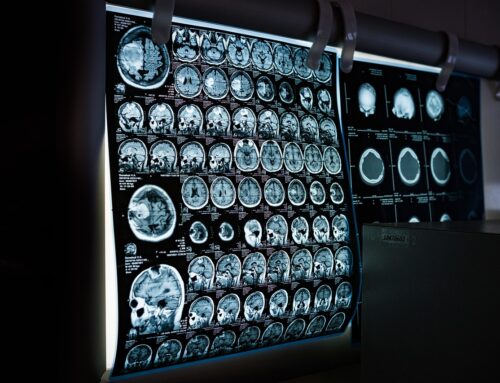 Minor vs. Serious Injuries: What’s the Difference?